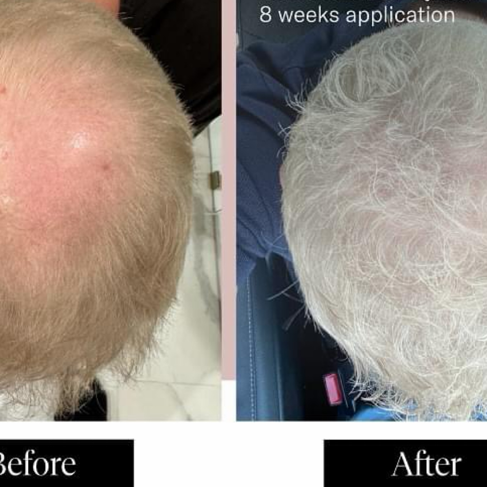 ⭐️Complete Transformation Package at The Glow Studio in Sioux Falls, SD
