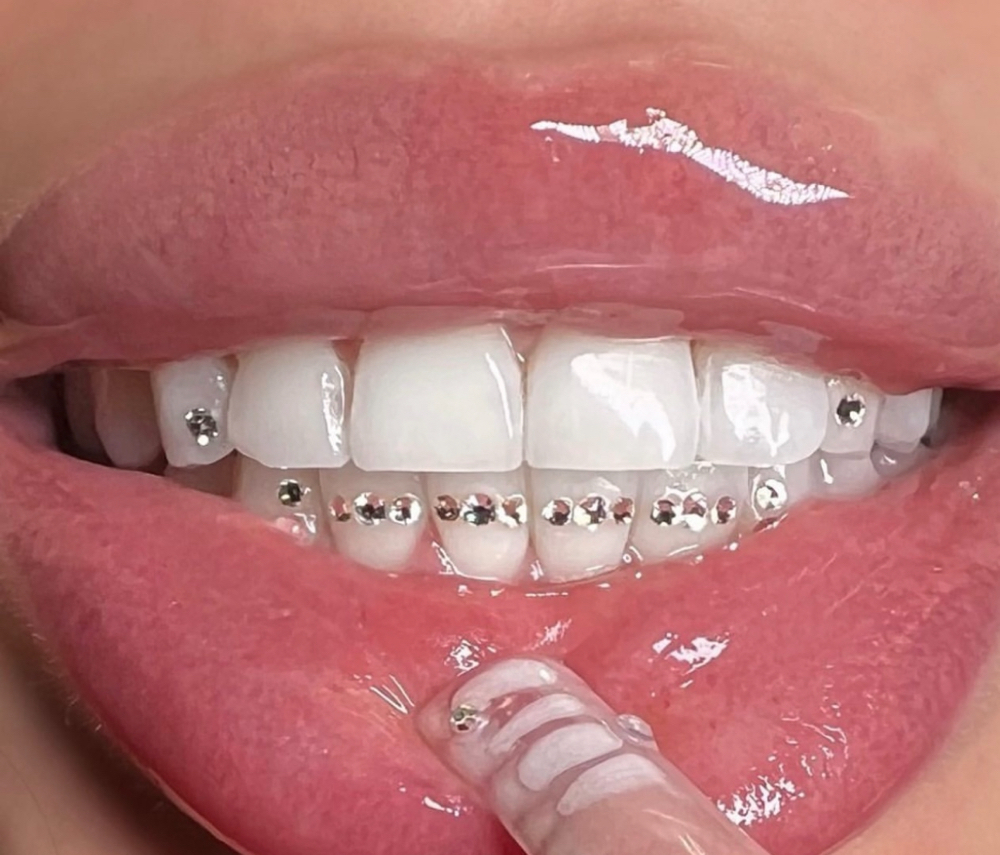 Tooth Gems