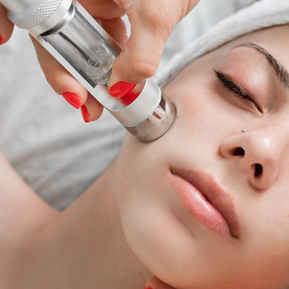 No-needle Mesotherapy at Aries Beauty & Wellness in Chandler, AZ