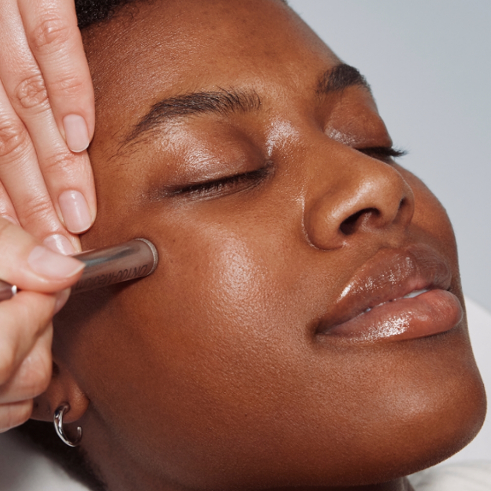 Microdermabrasion Facial at Blue Diamond Bodysculpting in Willoughby, OH