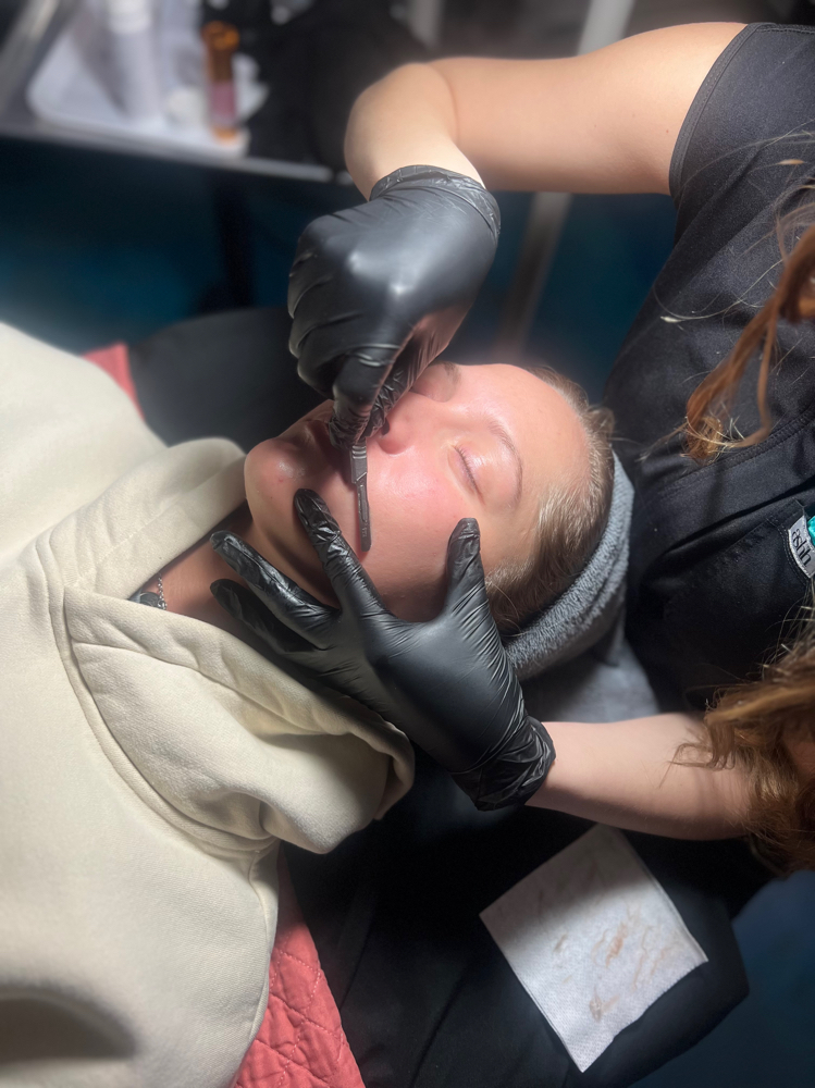 Dermaplaning