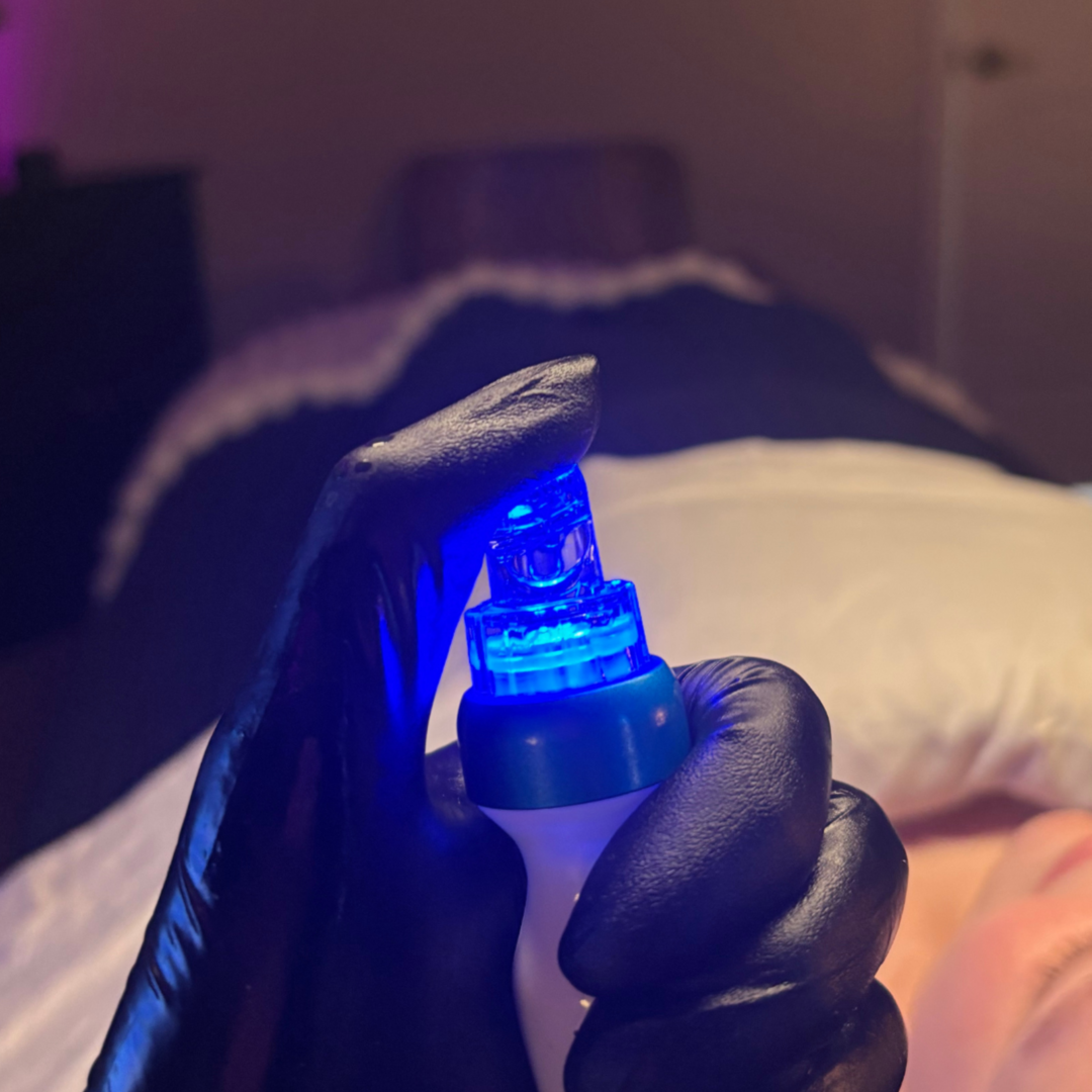 Thrive Hydrofacial + Dermaplain