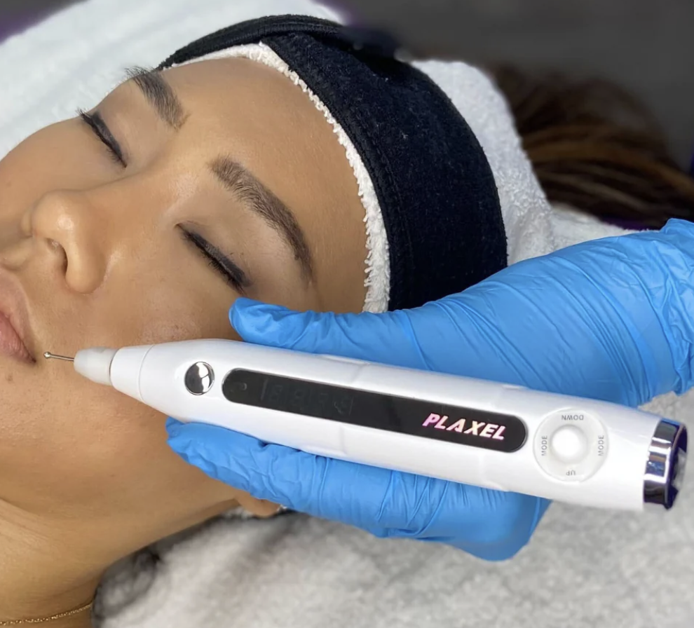 Plasma tx for warts, skin tags etc.
