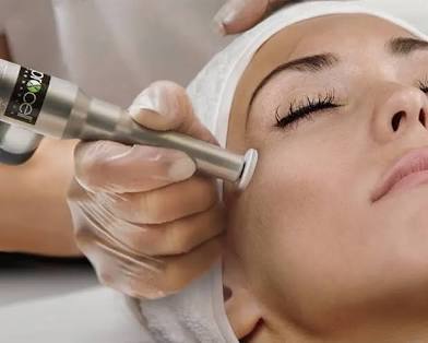 Microchanneling Facial at ReBourne Aesthetics and Wellness in Ridgland, MS