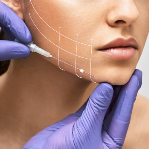 Mono Threads at E.V. Aesthetics in Torrance, CA