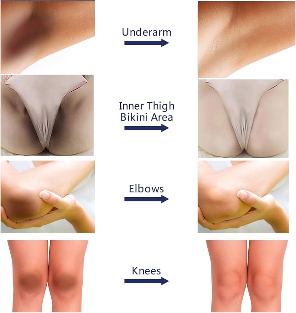 Intimate Area Bleaching