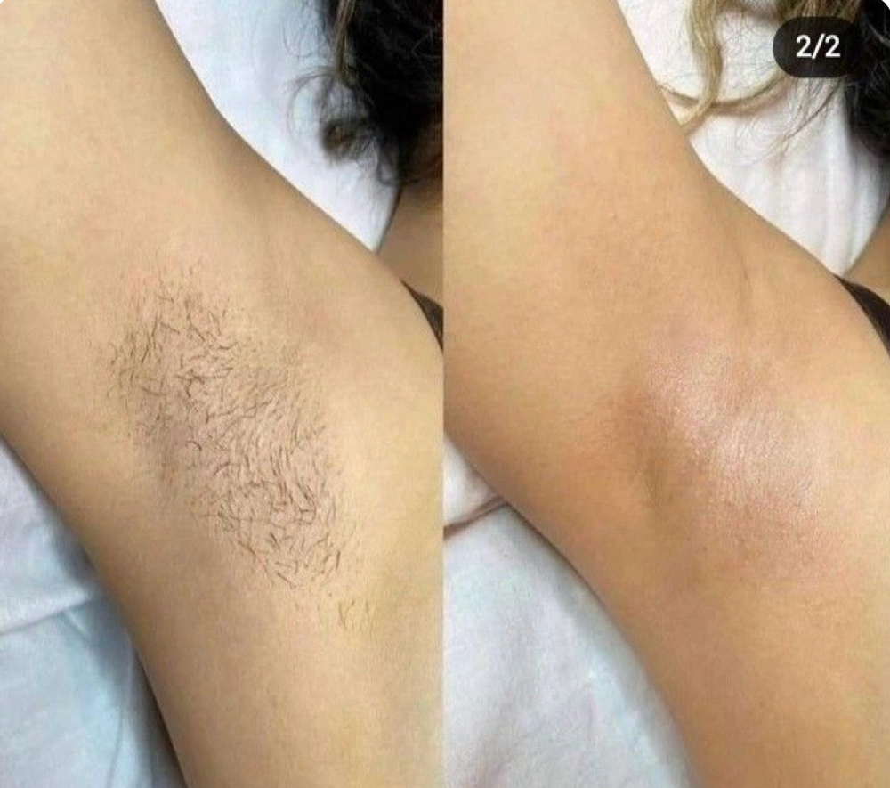 Underarms Wax at Radiance & Kay the Beautician, LLC in Bulverde, TX