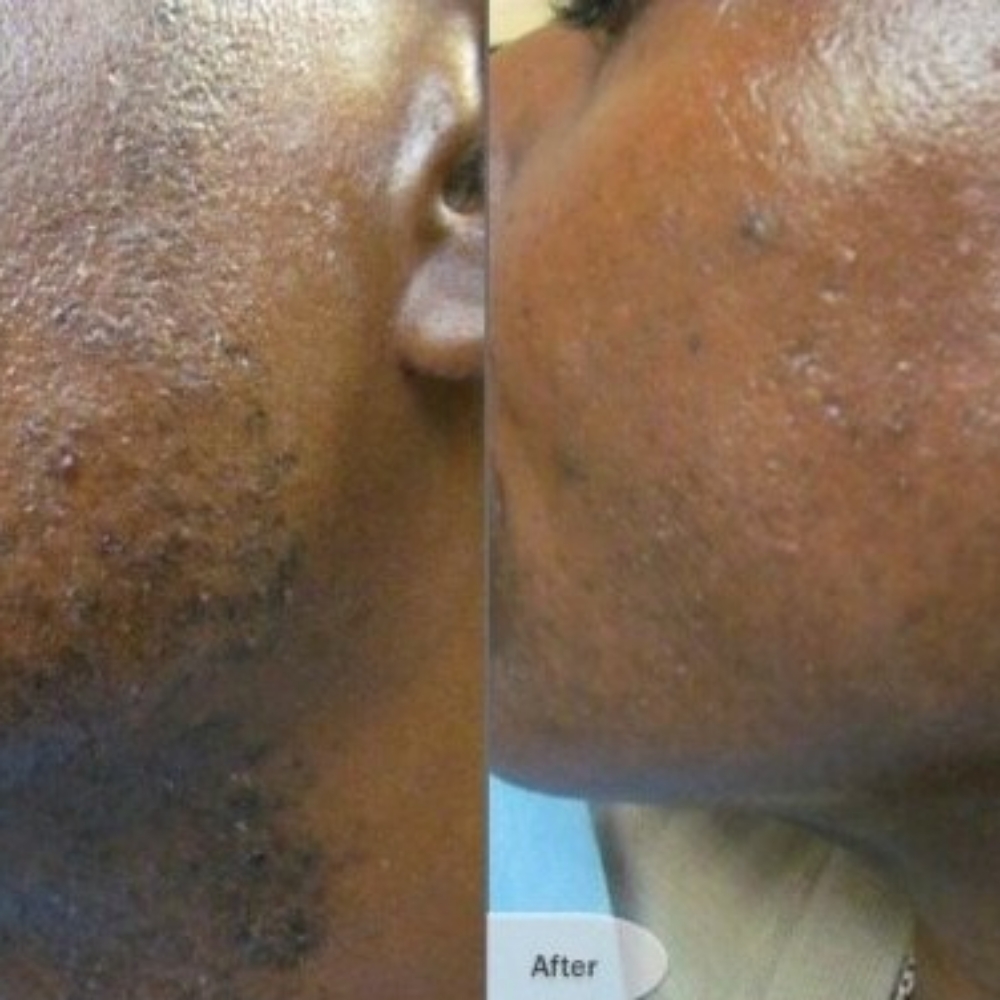 🌟 Men's Beard Treatment at JUST BEAUTIFUL SKIN in Goose Creek, SC