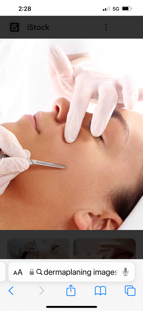 Dermaplaning