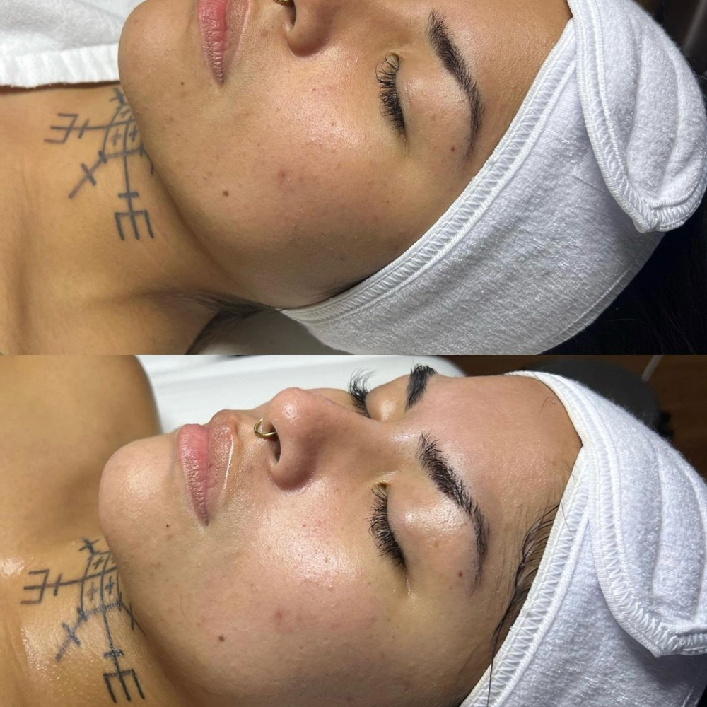 Signature Facial
