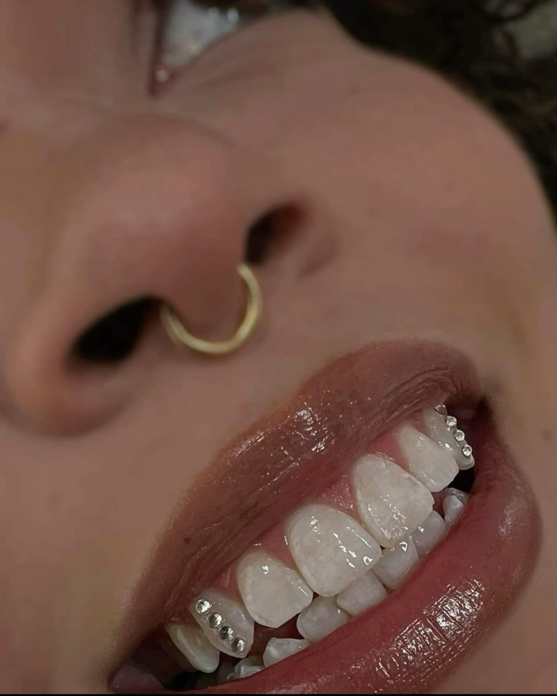 Tooth Gem Model