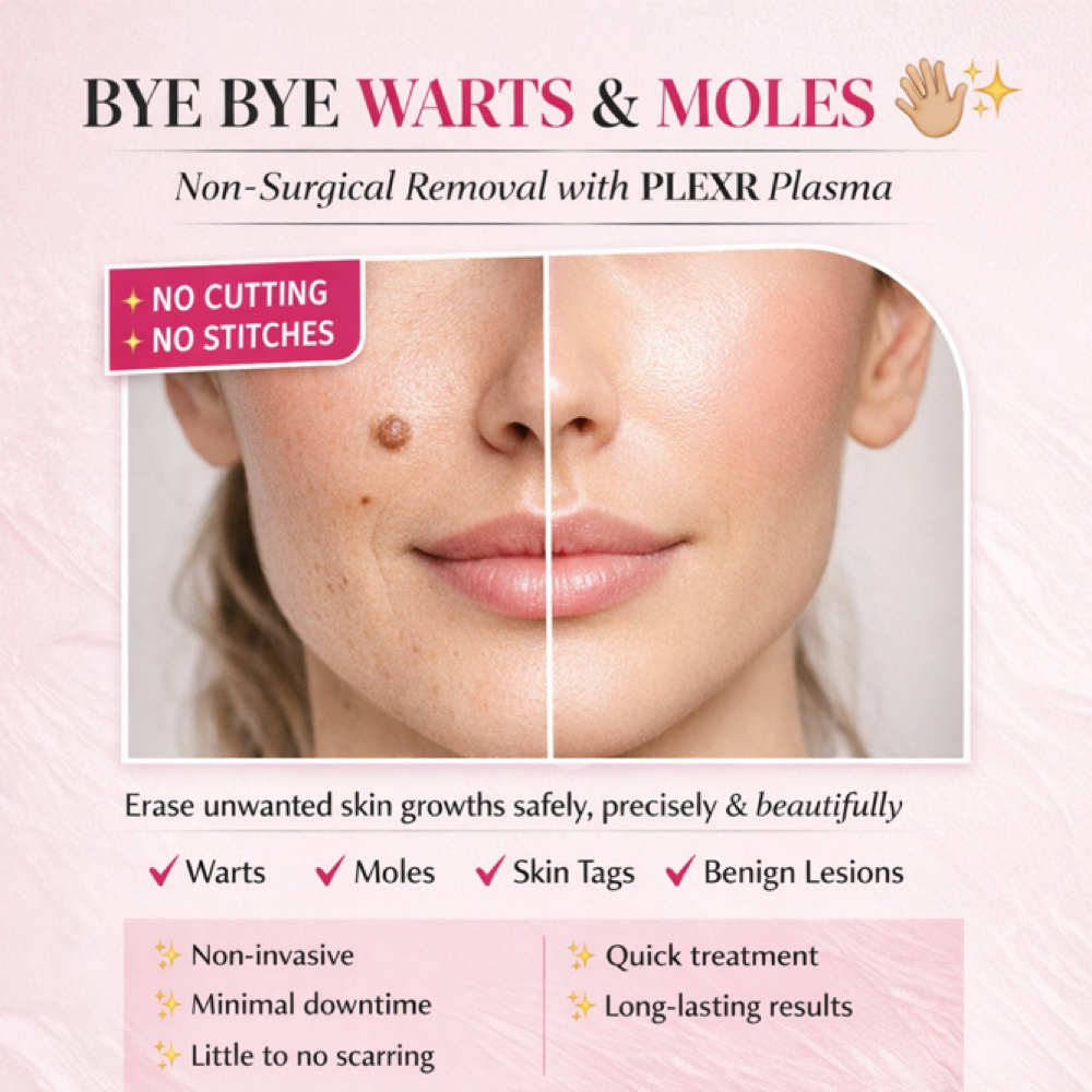 BYE BYE WARTS & MOLES at Plump Haus LA in Beverly Hills, CA