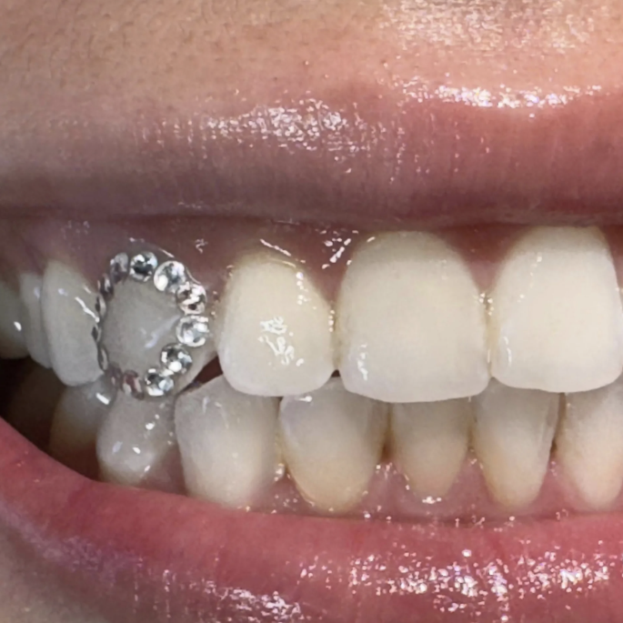 Outline Tooth Gem Design