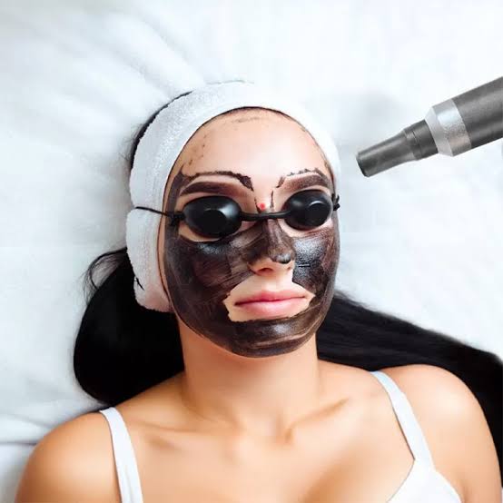 HOLLYWOOD CARBON PEEL