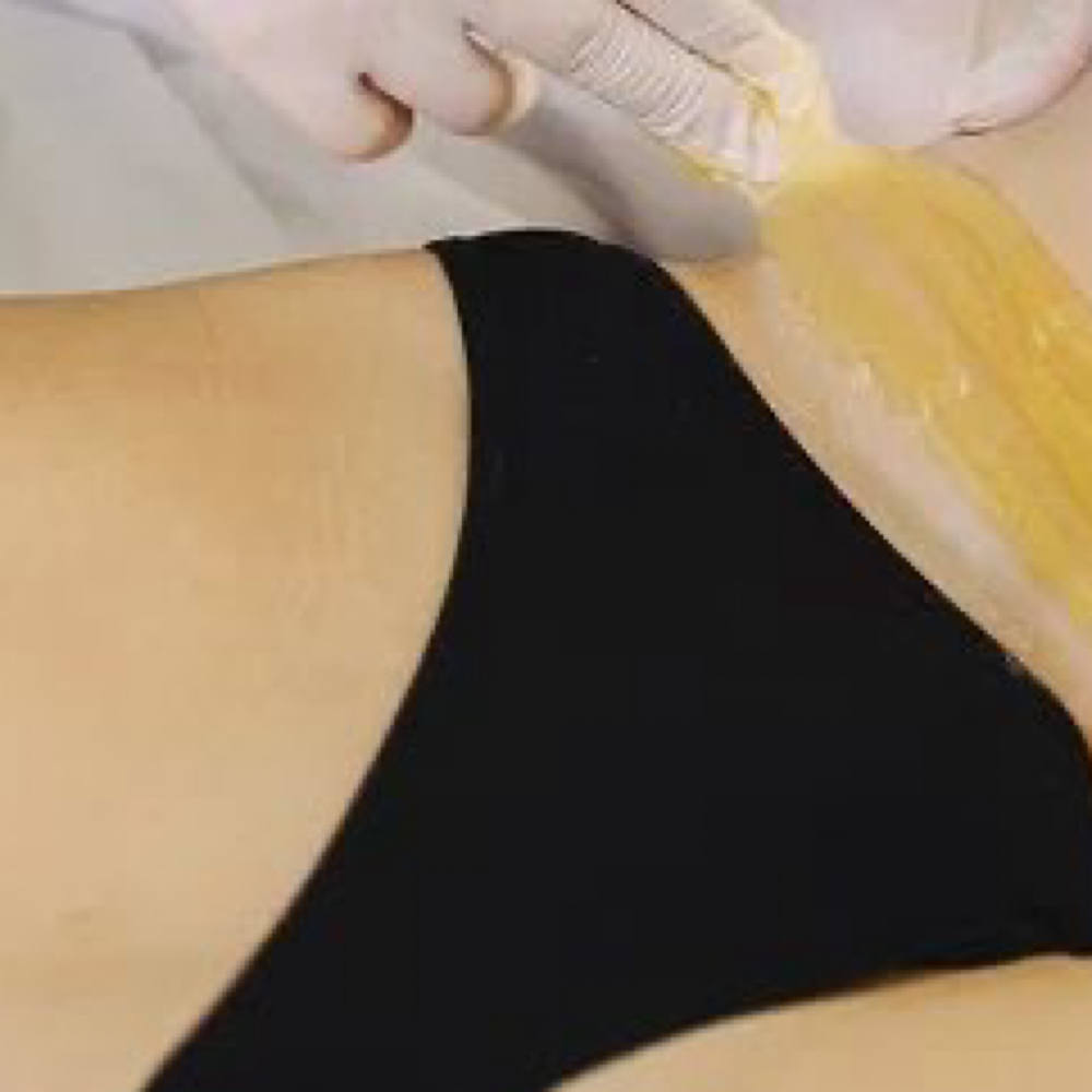 Bikini Wax at Pearly Derm in Sun valley, CA