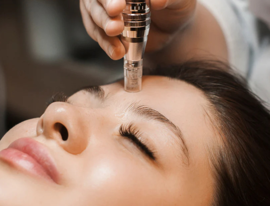 Nano Infusion (Add On) at The Tranquility Bar in Alburtis, PA