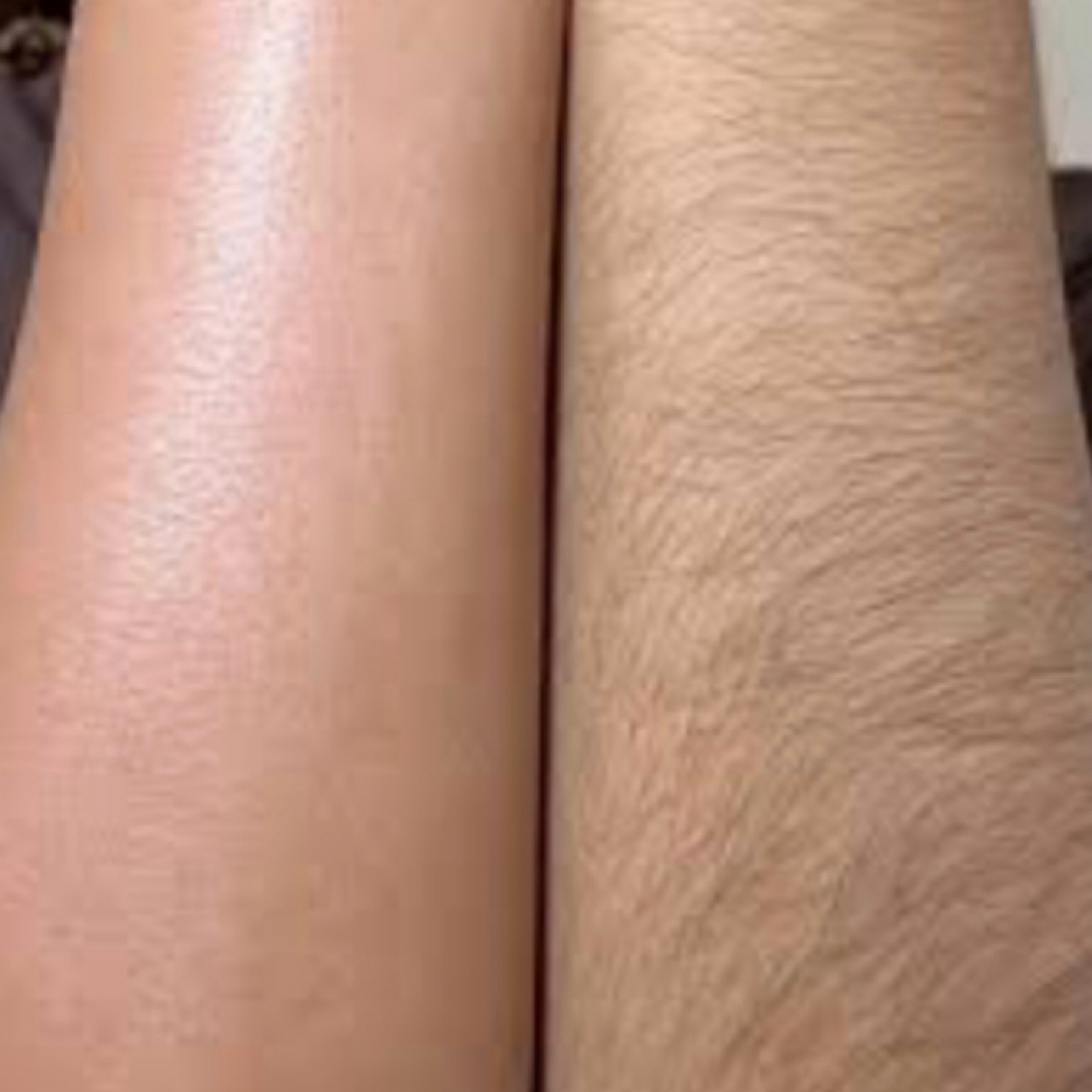 Arms at Shea Beauty Bar in Pineville, LA