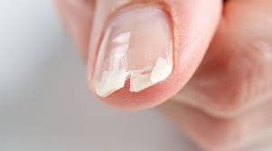 Nail Fix
