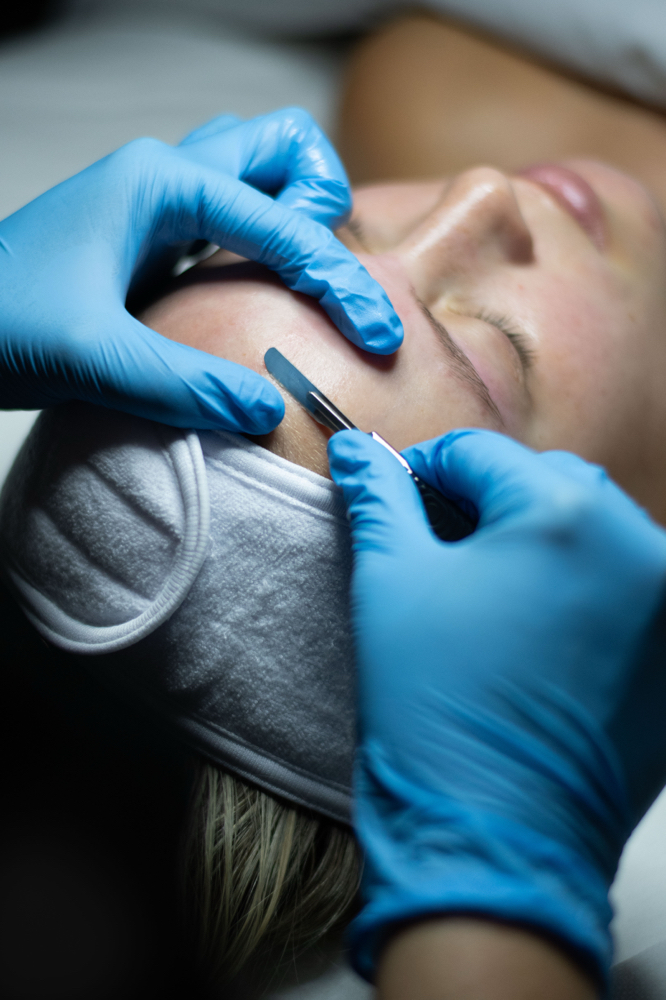 Dermaplane Facial