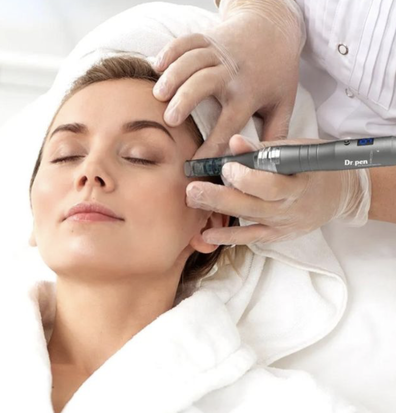 Mirco-Needling with Stem Cells