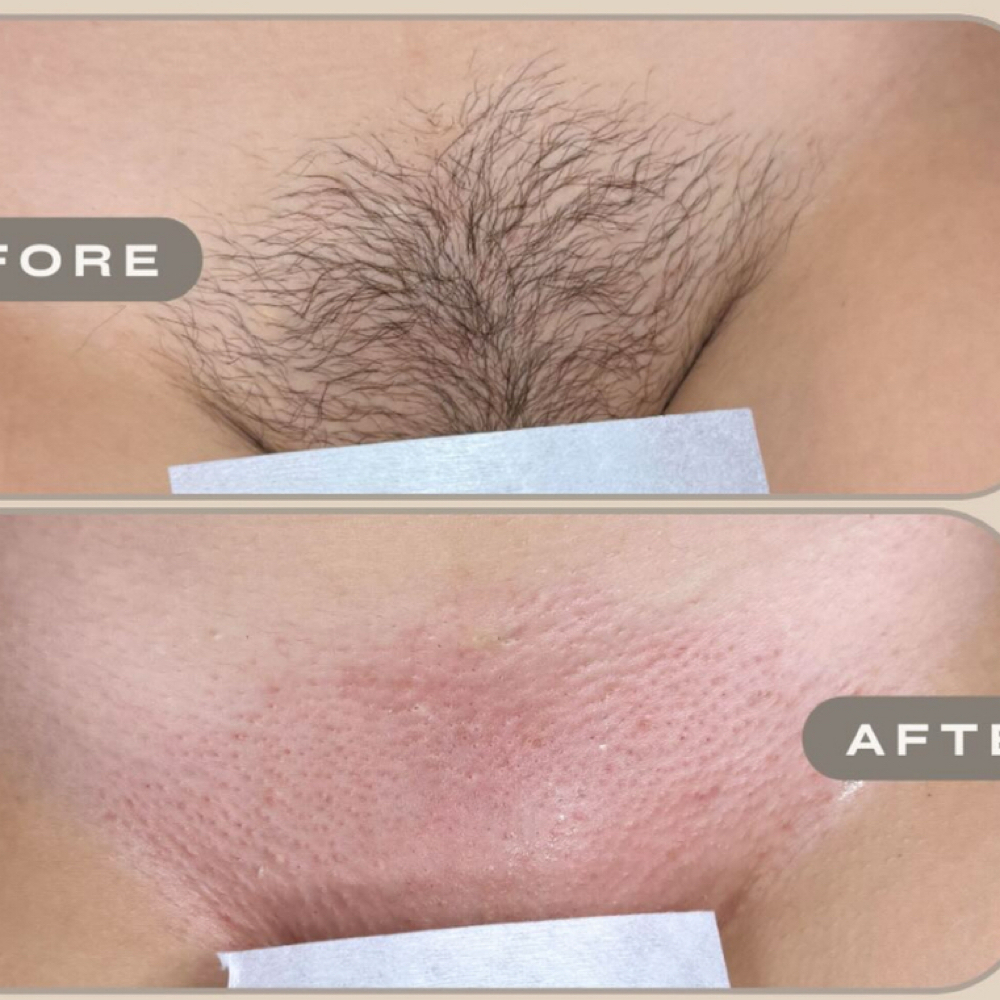 Brazilian limited time offer at Sexymakeupnailsbeauty in Temecula, CA