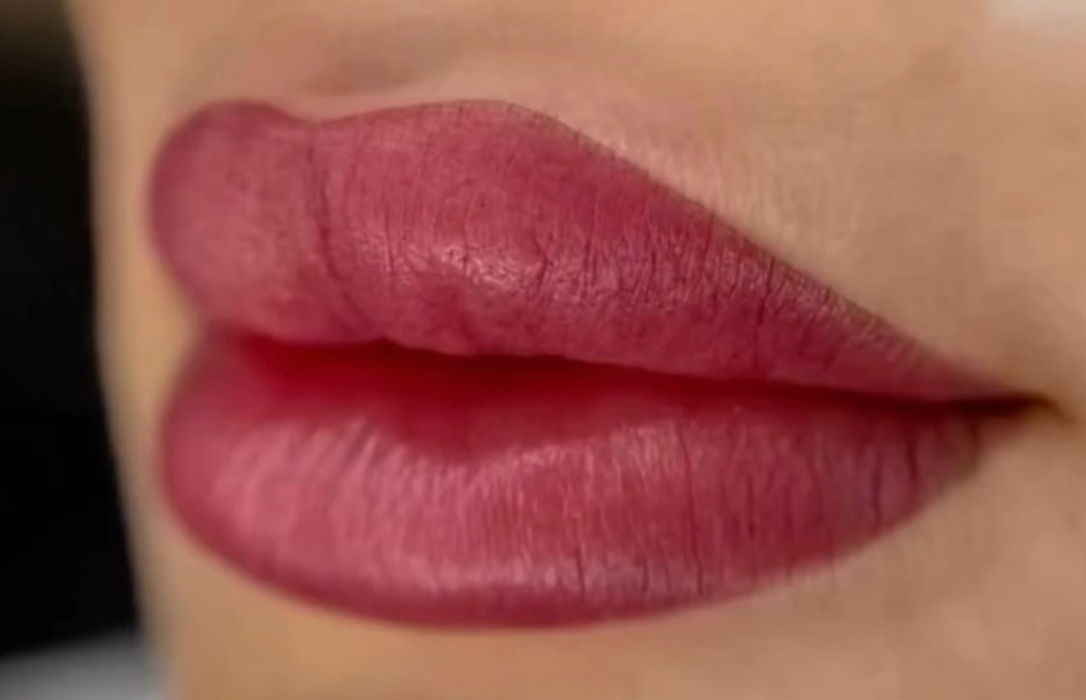 Lip Pigmentation
