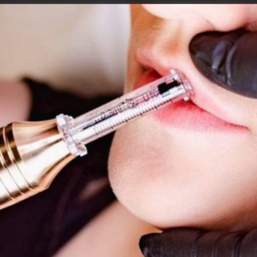 Lip Filler 2ml at Mermaid Riot in Lockbourne, OH