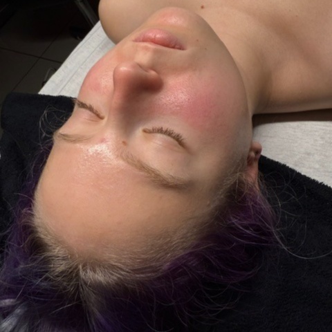 Dermaplaning Facial at Bare Alchemy by Madison LLC in Hayden, ID