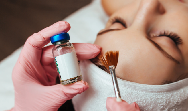 Chemical Peel Add-On