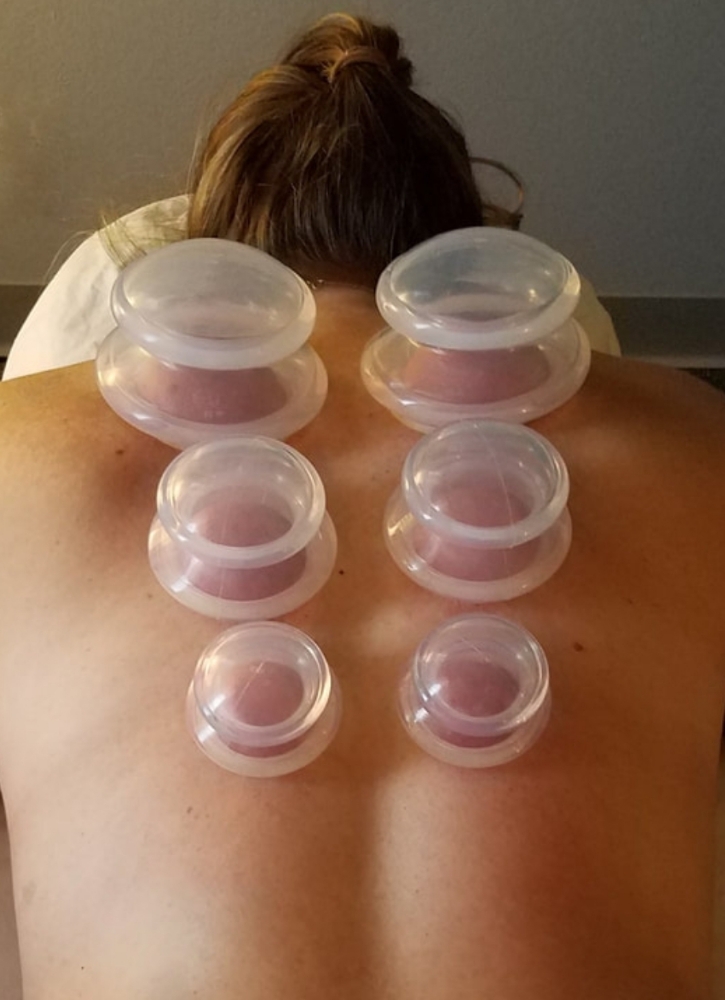 Silicone CUPPING