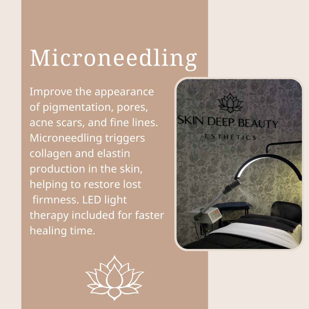 Microneedling