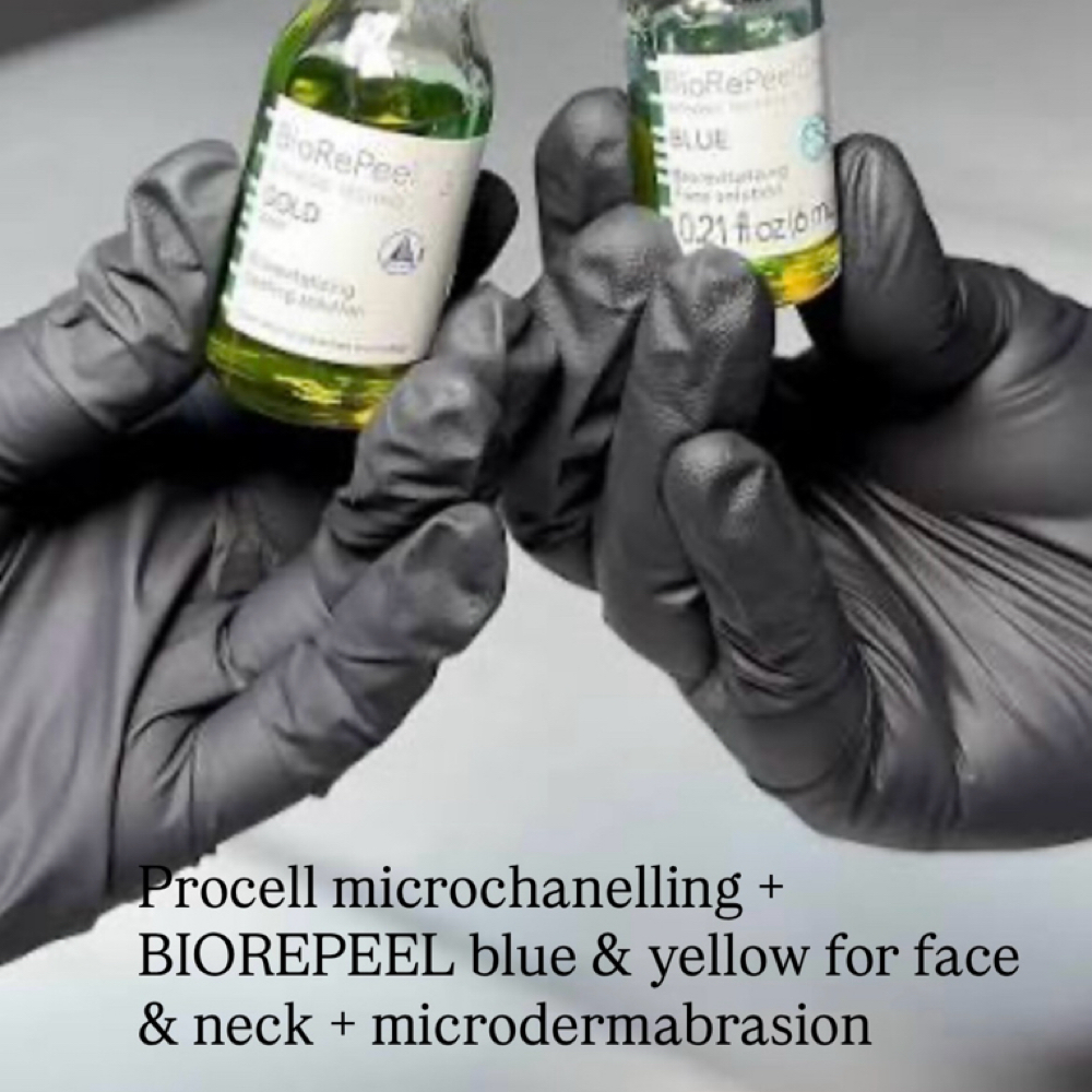 Procell+biorepeel blue+gold+microde at Skincare by Carmen Dindo in Sarasota, FL