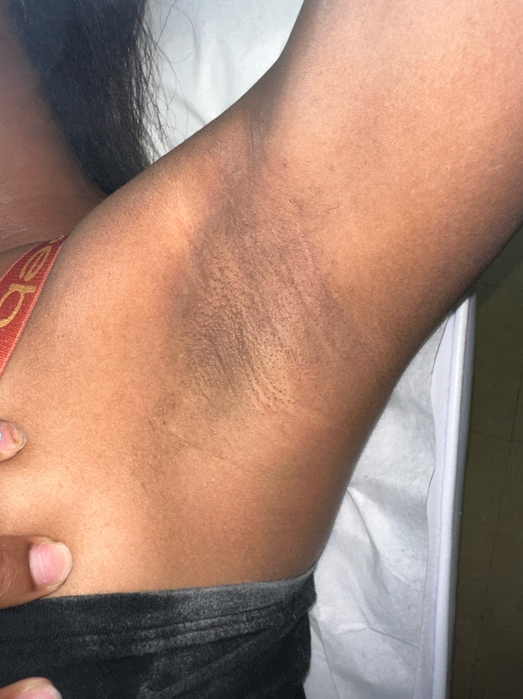Underarm Wax