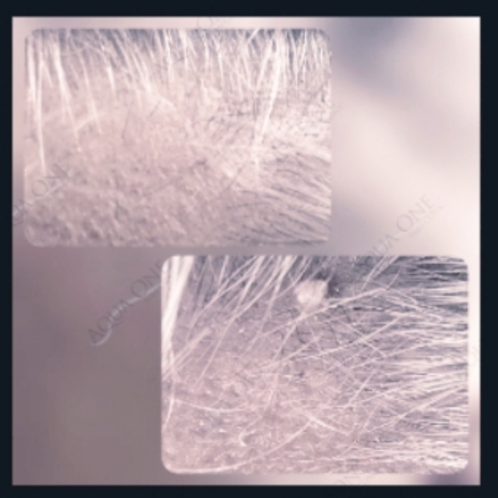 Brown Spot/Skin Tag- 3 at Aqua One Skin Clinic in Jasper, IN