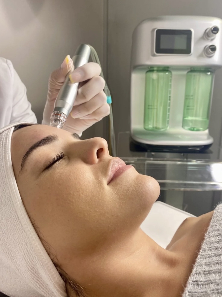 Hydrodermabrasion Facial