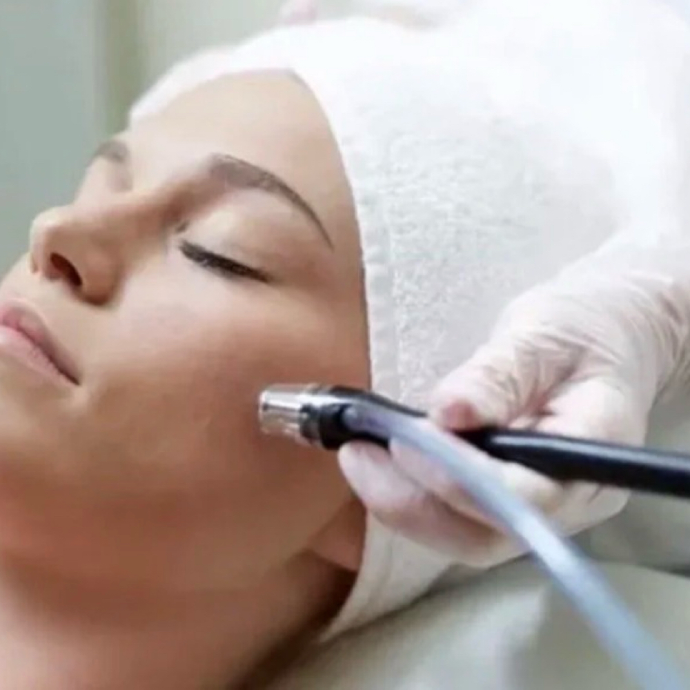 Microneedling - Full Face & Neck & at Tracy WellBeing Retreat & Salon in Tracy, CA