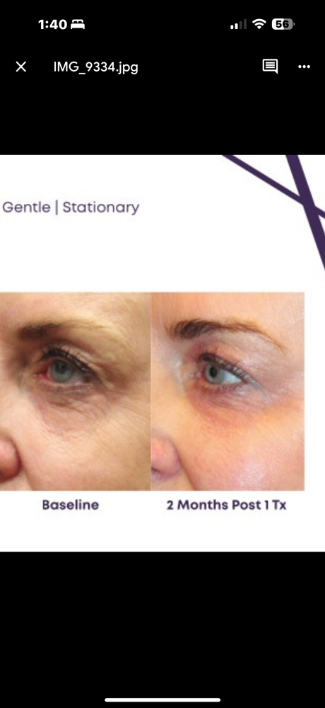 Saggi Skin Under-Eye Treatment