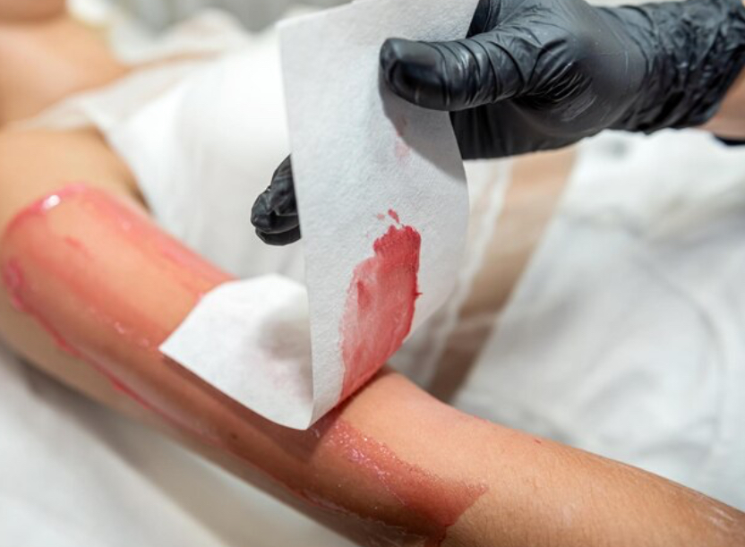 Full Arm Waxing