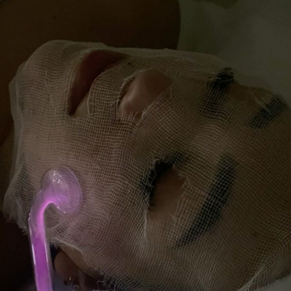 High-Frequency Therapy Add-On at GlowHaus Aesthetic in Medford, OR