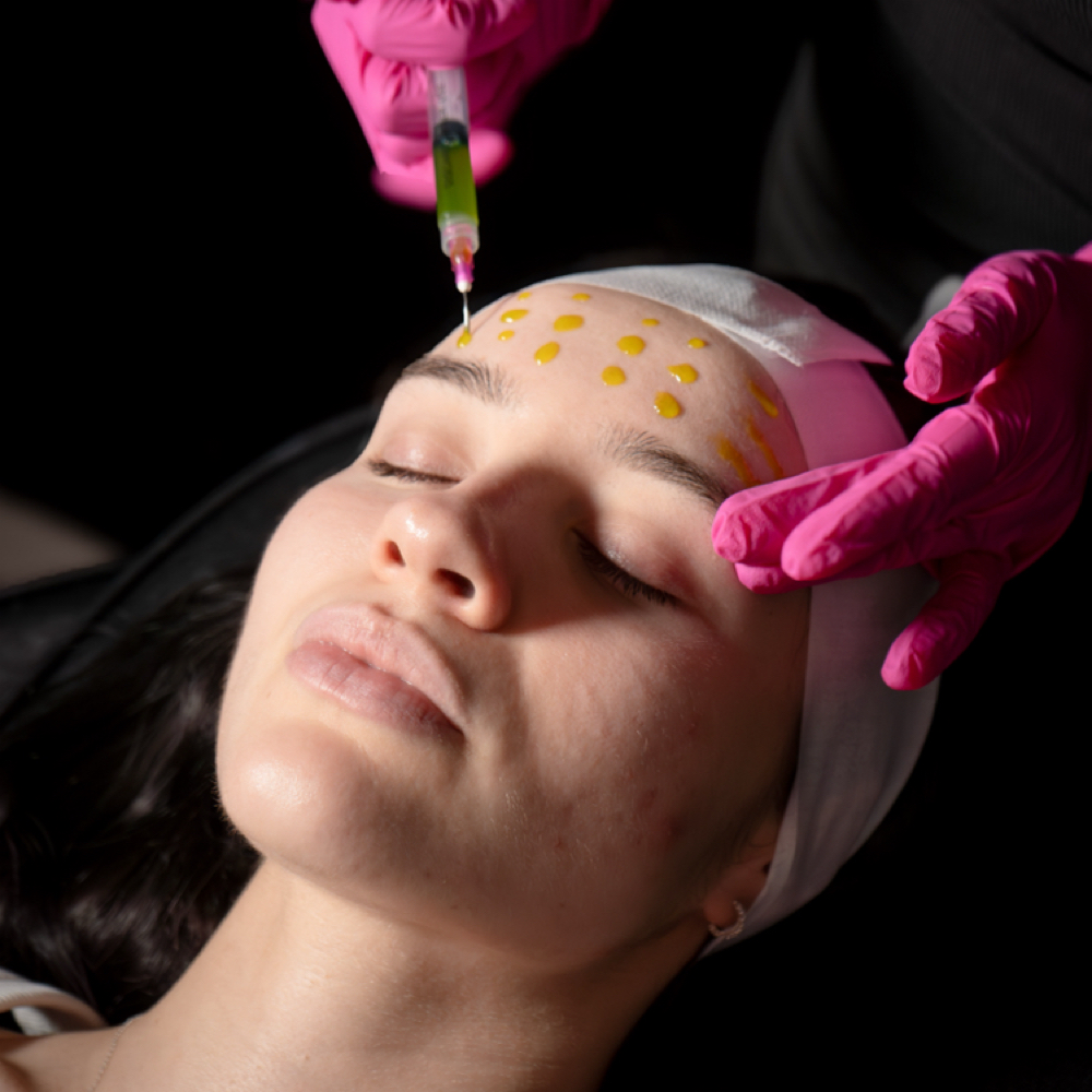 BioRePeel Chemical Peel at Alira Aesthetics in McAllen, TX