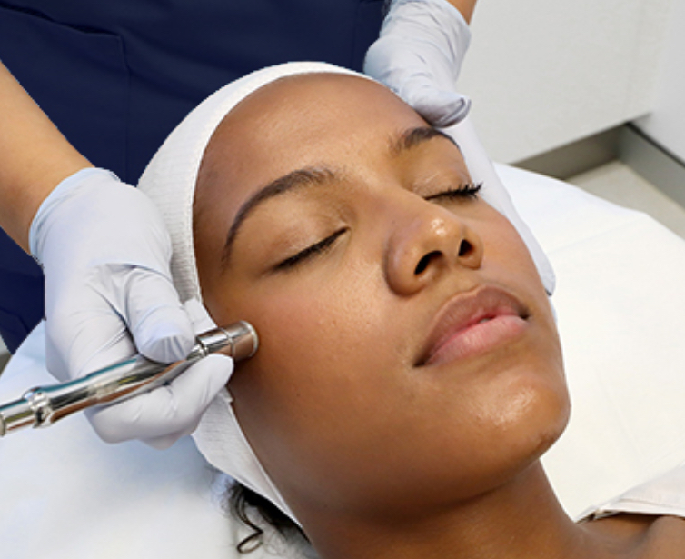 Microdermabrasion Facial