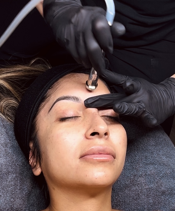 Microdermabrasion Facial at Radiant Beauty Collective By Rach in Rockford, IL