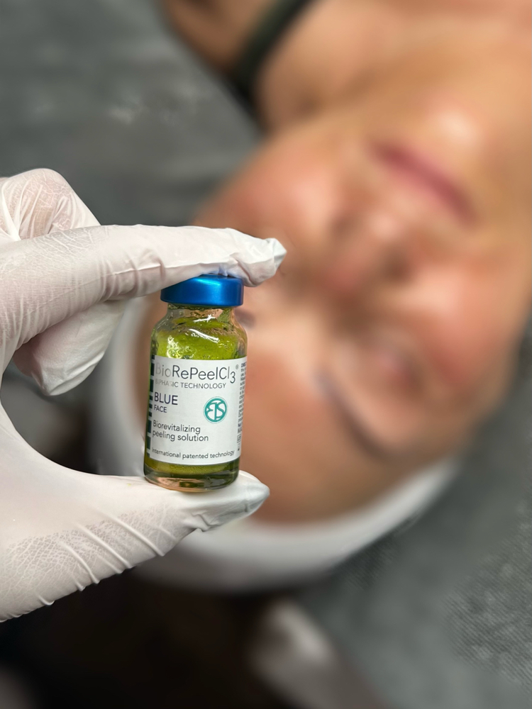 Microneedling at Evolve Your Skin in Surprise, AZ