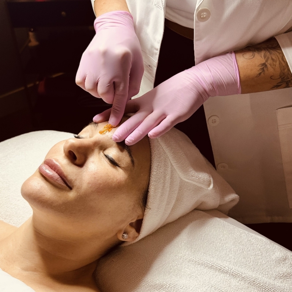 Full Face Sugaring at Avila Skin Studio in McKinney, TX