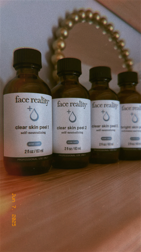 Chemical Peel