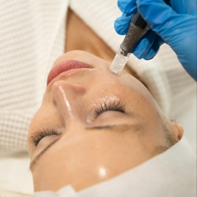 Nano Infusion Treatment at Enhanced Beauty by Madison Taylor in Spring, TX