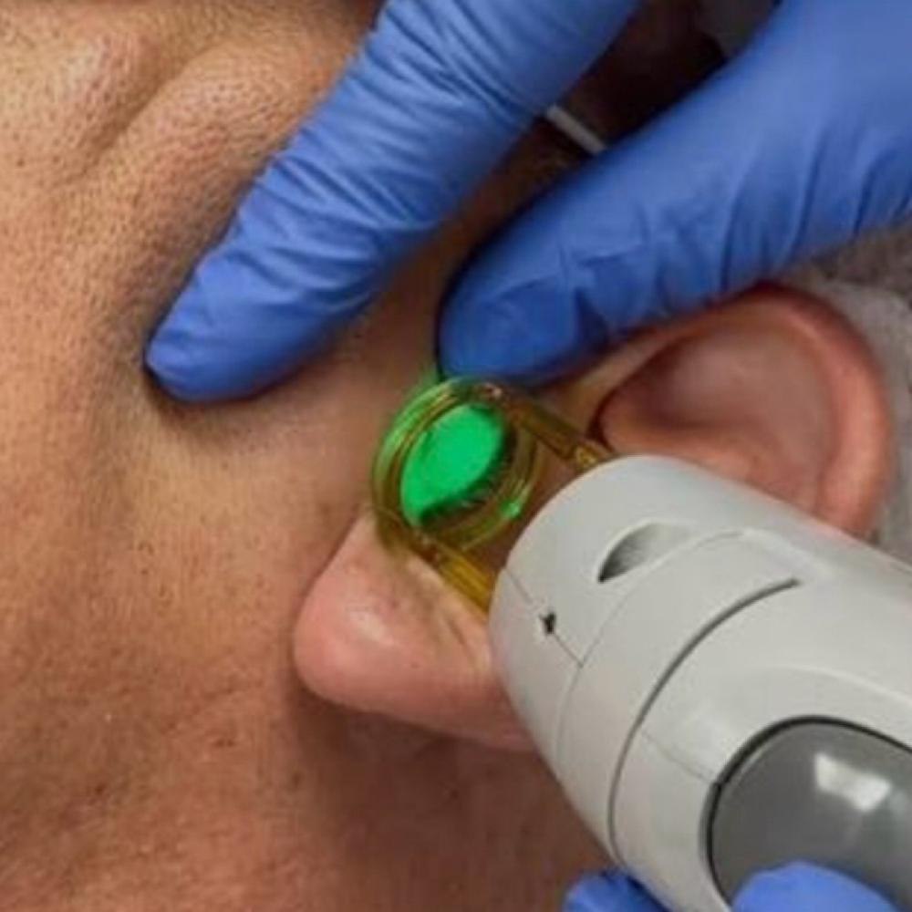 Ear Laser Hair Removal at Grand Beauty Spa in grand rapids, MI
