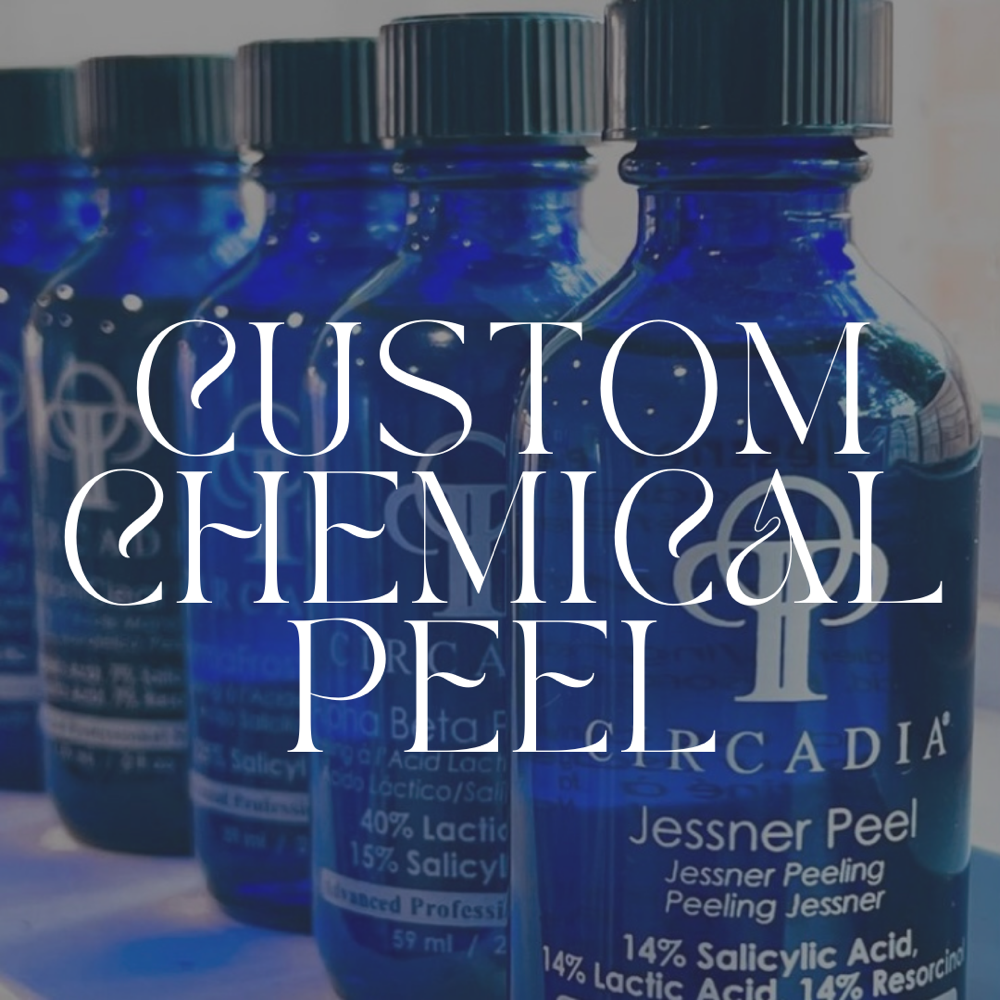 Custom Chemical Peel