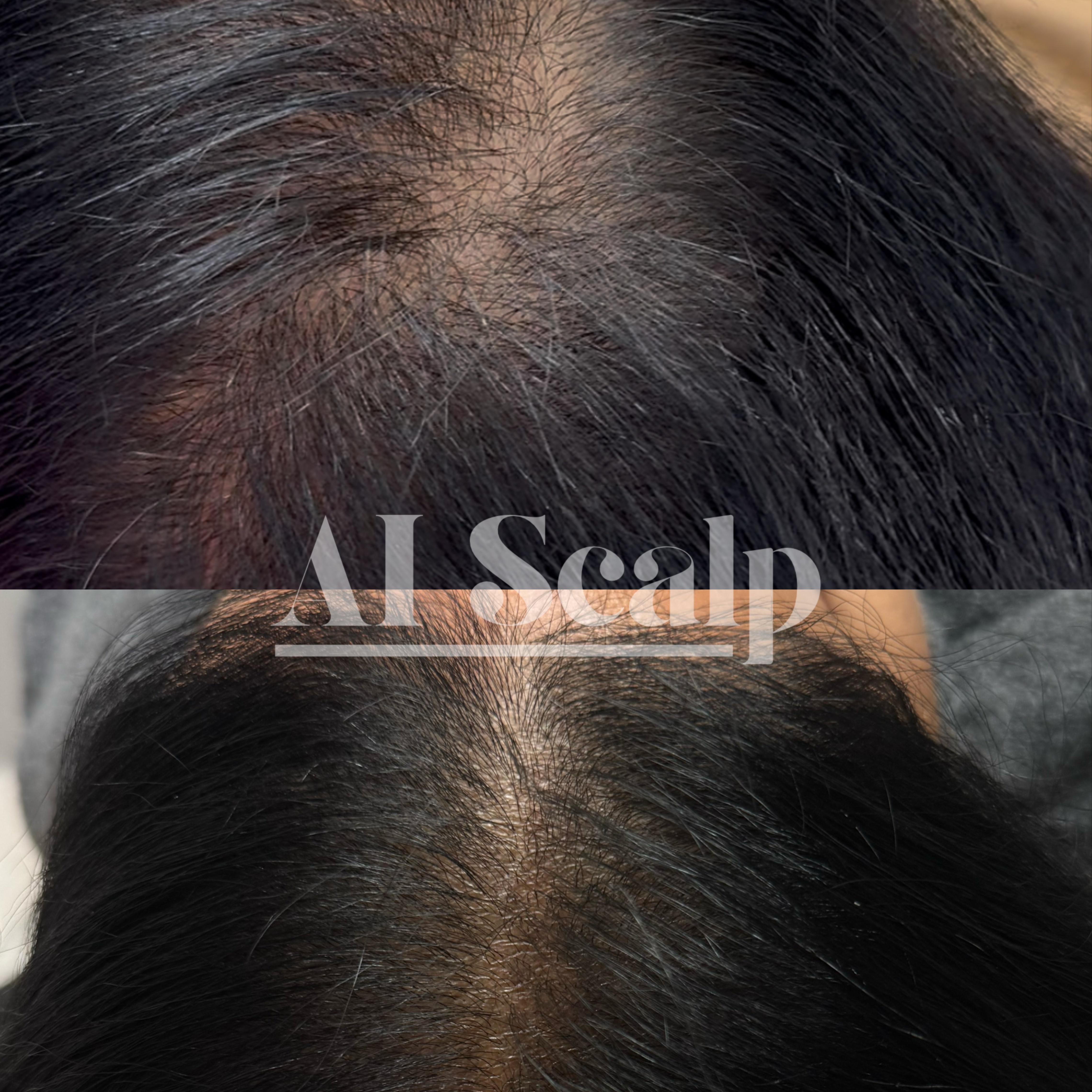 Ai Scalp - 3pk/Full Scalp at Alchemy Haus by Devyn | Color. Extensions. Scalp Density. in Atlanta, GA