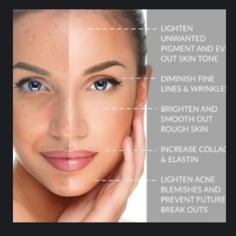 Chemical Peel at Skin & Toxx Medical Spa Westchase in Houston, TX